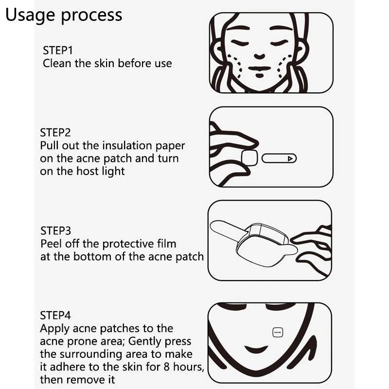 Electronic Beauty Device For Cleansing  And Fading Acne Marks-TRENSI