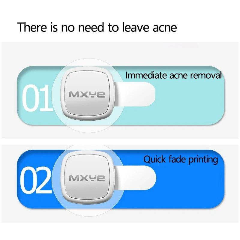 Electronic Beauty Device For Cleansing  And Fading Acne Marks-TRENSI
