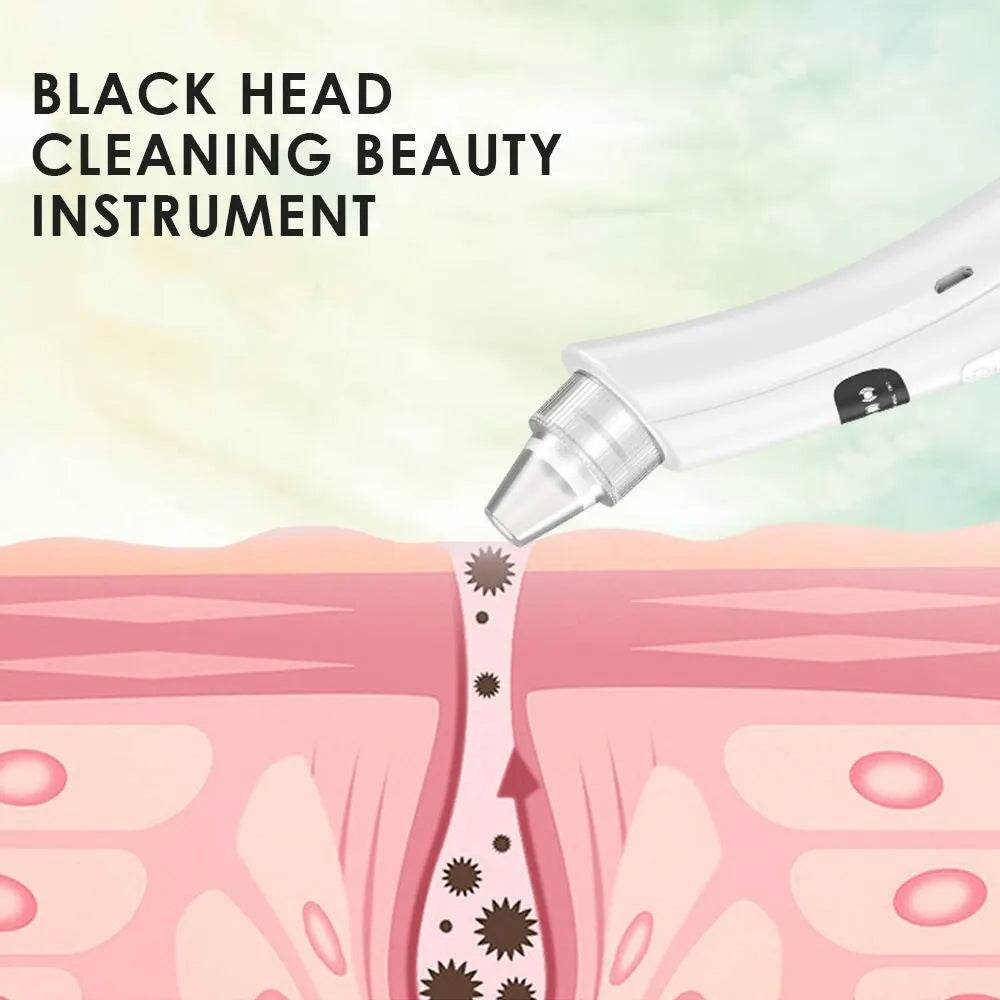 TRENSI beauty tool used for facial cleansing and exfoliation